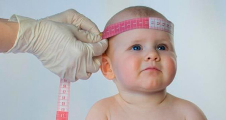 Mortes-bebes-microcefalia-investigadosPernambuco